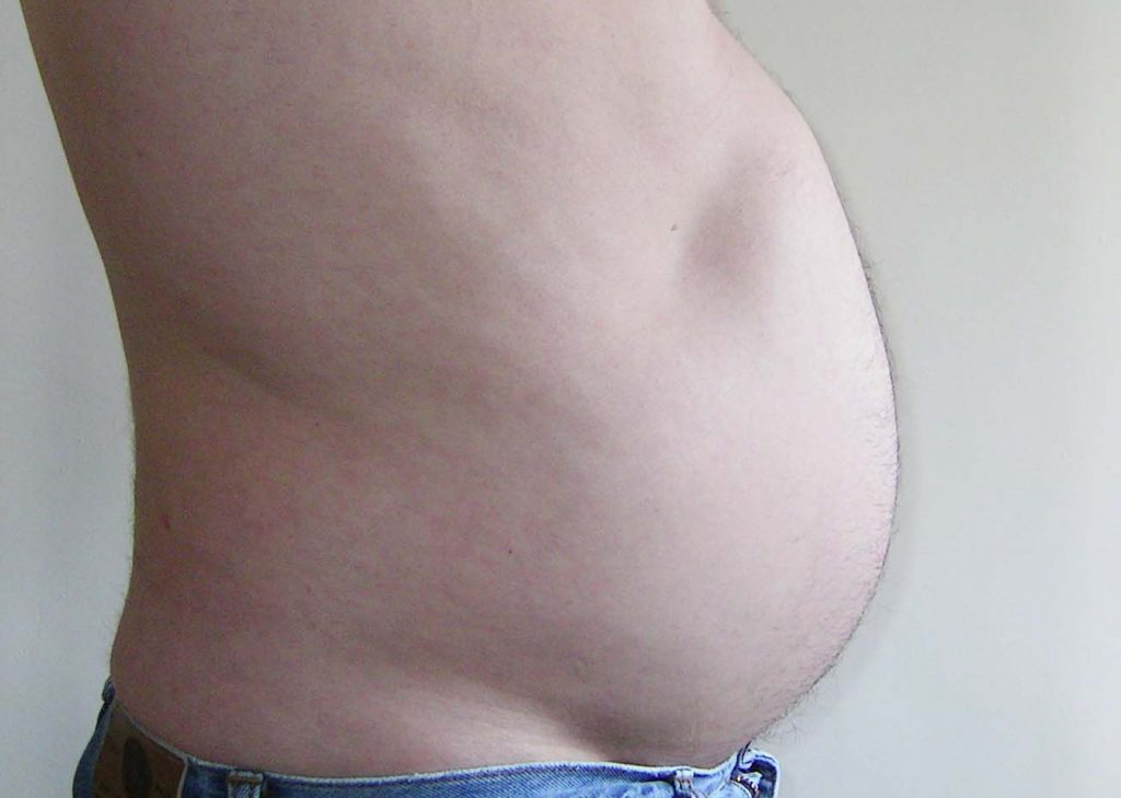 beer belly