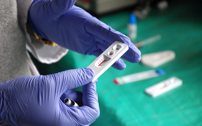 africa hiv aids dropped dramatically